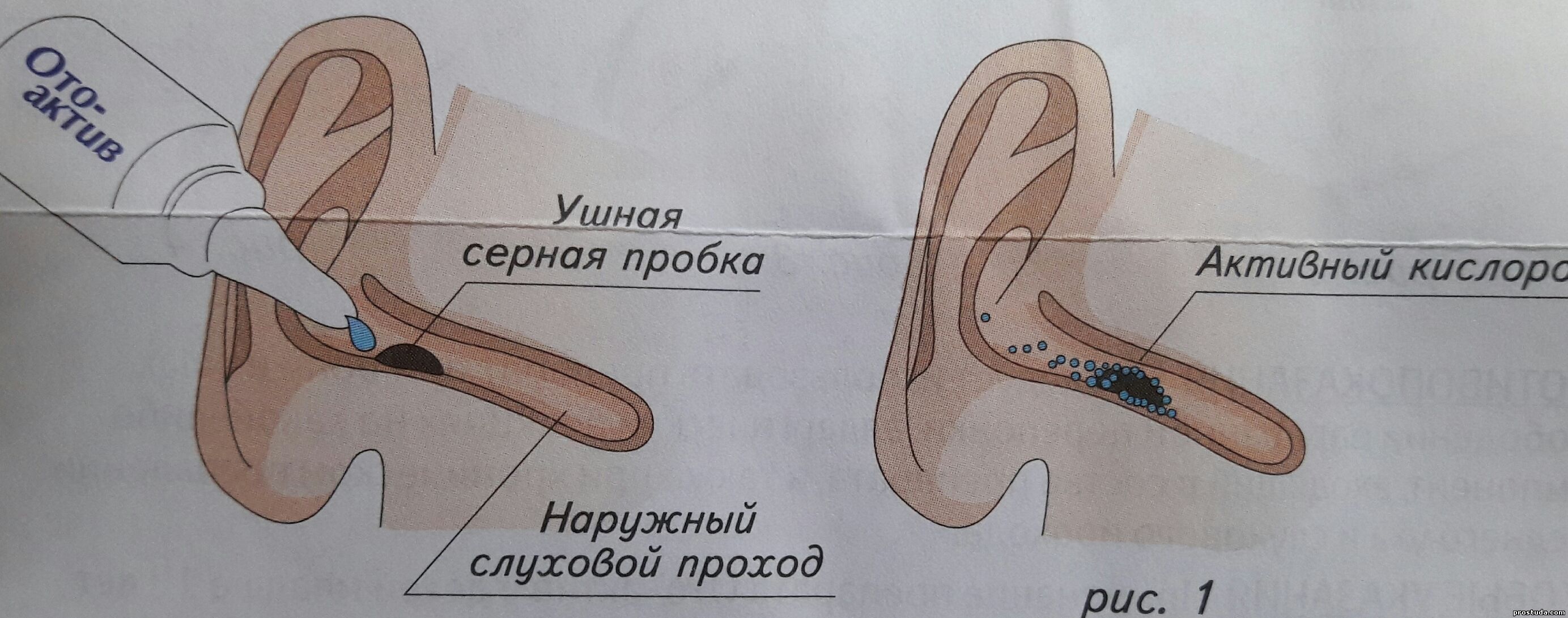 Ото-актив рисунок 1